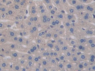 Polyclonal Antibody to Interleukin 17 Receptor A (IL17RA)