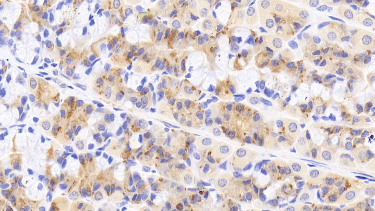 Polyclonal Antibody to Interleukin 18 Receptor 1 (IL18R1)