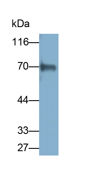 Polyclonal Antibody to Interleukin-18 Receptor Beta (IL18R Beta)