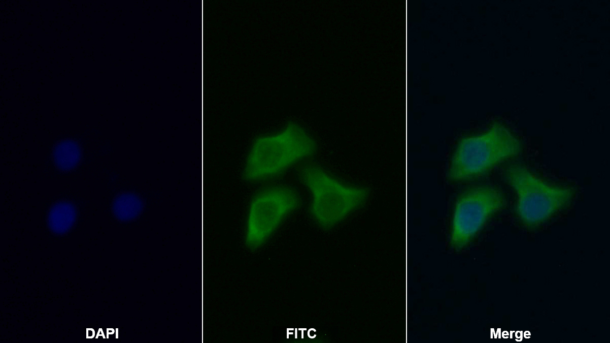 Polyclonal Antibody to Protein Kinase, AMP Activated Beta 1 (PRKAb1)