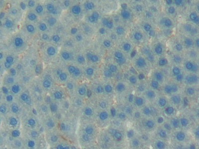Polyclonal Antibody to Insulin Like Growth Factor Binding Protein 7 (IGFBP7)
