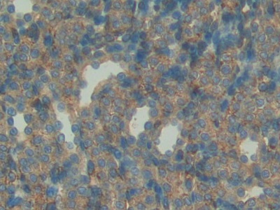 Polyclonal Antibody to Insulin Like Growth Factor Binding Protein 7 (IGFBP7)