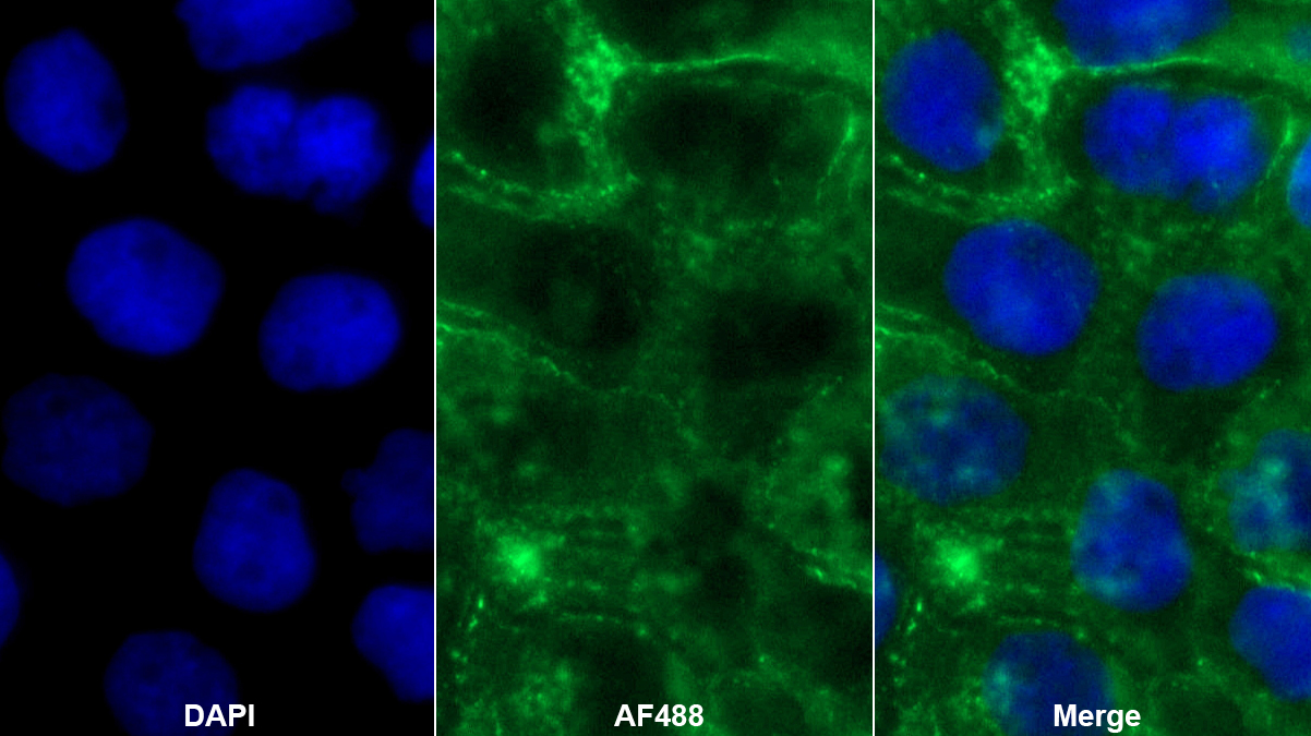 Polyclonal Antibody to Melanotransferrin (MFI2)