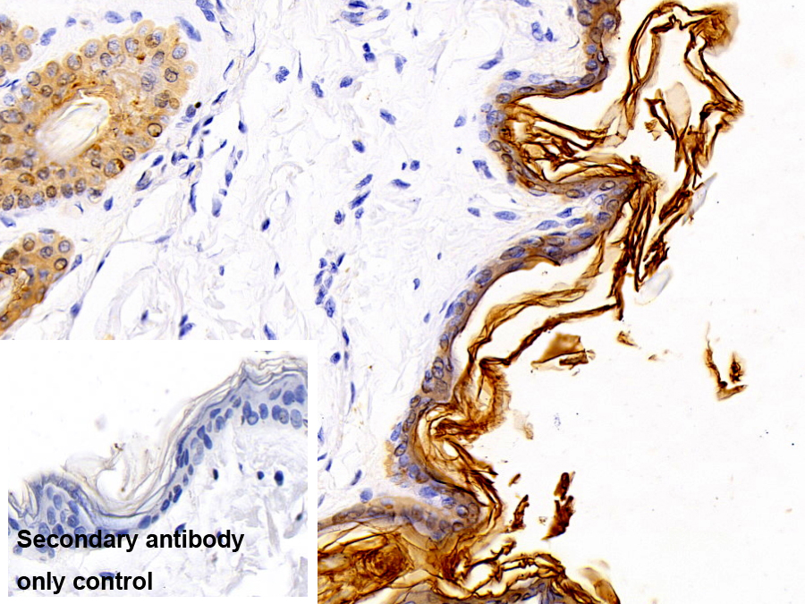 Polyclonal Antibody to Cytokeratin 10 (CK10)