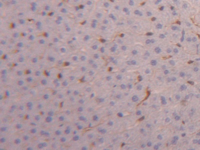 Polyclonal Antibody to Fatty Acid Binding Protein 4 (FABP4)