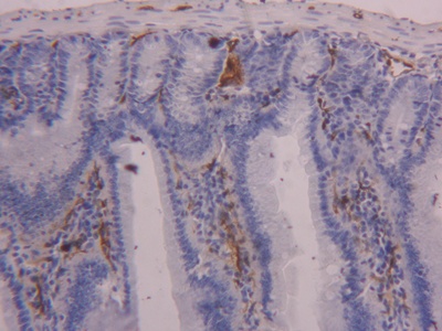 Polyclonal Antibody to Fatty Acid Binding Protein 4 (FABP4)