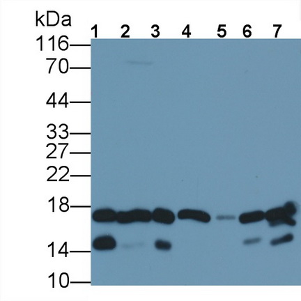 Polyclonal Antibody to Fatty Acid Binding Protein 4 (FABP4)