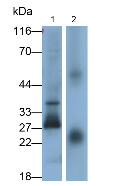 Polyclonal Antibody to Interleukin 25 (IL25)