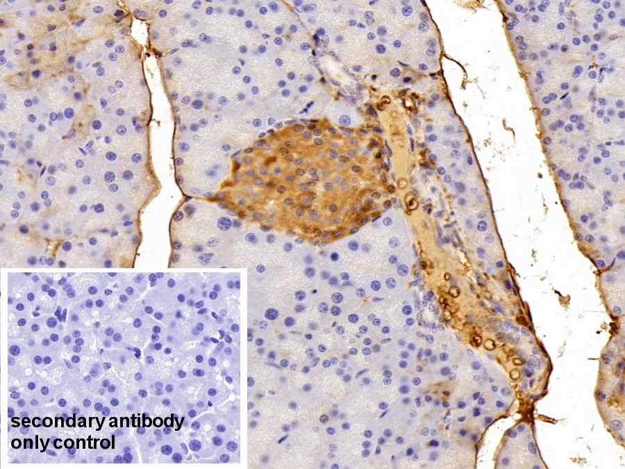 Polyclonal Antibody to Alpha-1-Antitrypsin (a1AT)