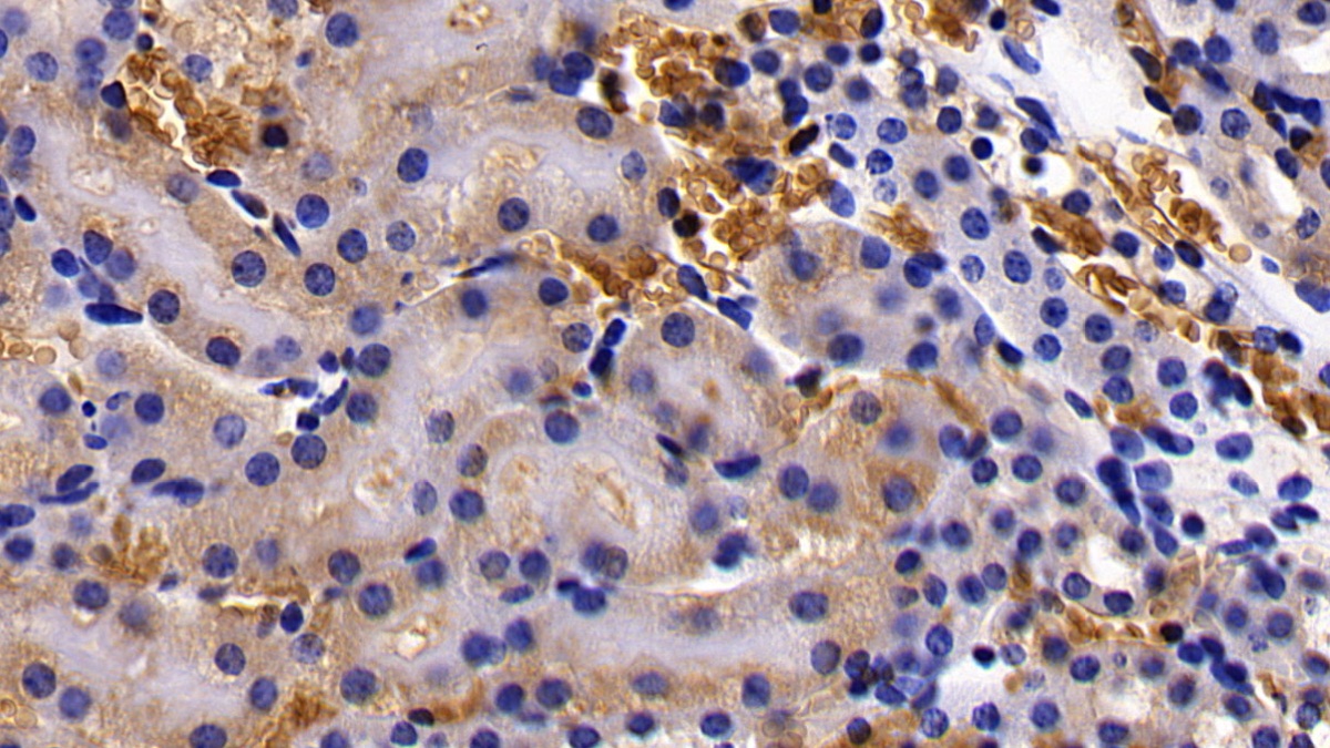 Polyclonal Antibody to Glycophorin A (GYPA)