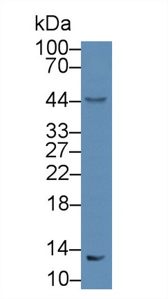 Polyclonal Antibody to T-Cell Leukemia/Lymphoma Protein 1A (TCL1A)