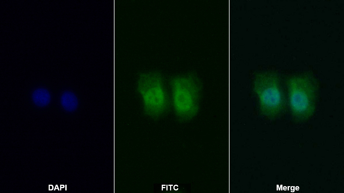 Polyclonal Antibody to Protein Kinase B Beta (PKBb)