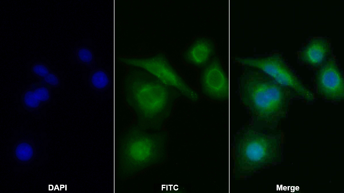 Polyclonal Antibody to Mitogen Activated Protein Kinase Kinase 6 (MAP2K6)