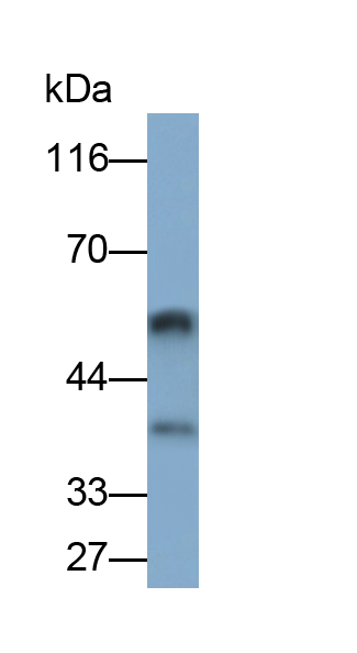 Polyclonal Antibody to Pyridoxal Kinase (PDXK)