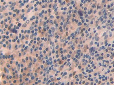 Polyclonal Antibody to Oncoprotein Induced Transcript 3 (OIT3)