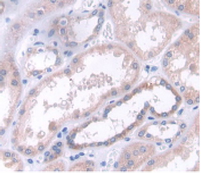 Polyclonal Antibody to C-Type Lectin Domain Family 4, Member C (CLEC4C)