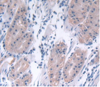 Polyclonal Antibody to C-Type Lectin Domain Family 4, Member C (CLEC4C)