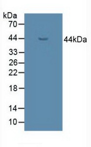 Polyclonal Antibody to UDP Glucose Ceramide Glucosyltransferase (UGCG)