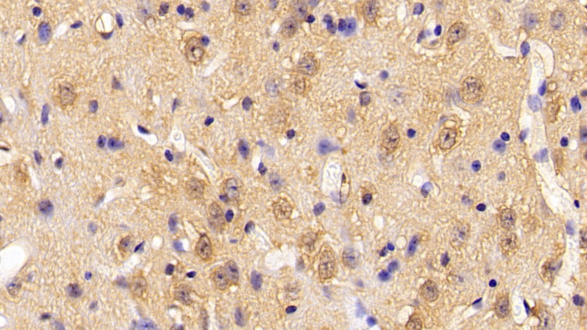 Polyclonal Antibody to Phosphofructokinase, Platelet (PFKP)