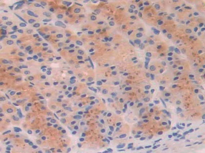 Polyclonal Antibody to Phosphofructokinase, Platelet (PFKP)