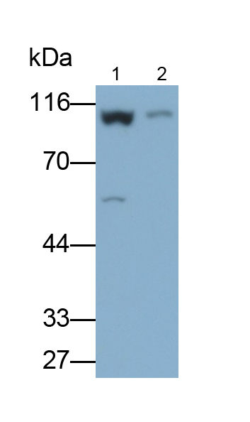 Polyclonal Antibody to Hexokinase 3, White Cell (HK3)