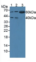 Polyclonal Antibody to Tryptophanyl tRNA Synthetase (WARS)