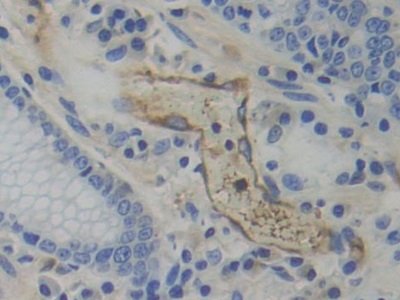 Polyclonal Antibody to Tryptophanyl tRNA Synthetase (WARS)