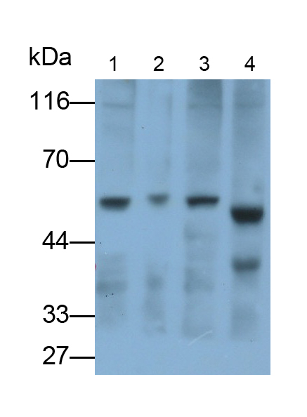 Polyclonal Antibody to Tryptophanyl tRNA Synthetase (WARS)