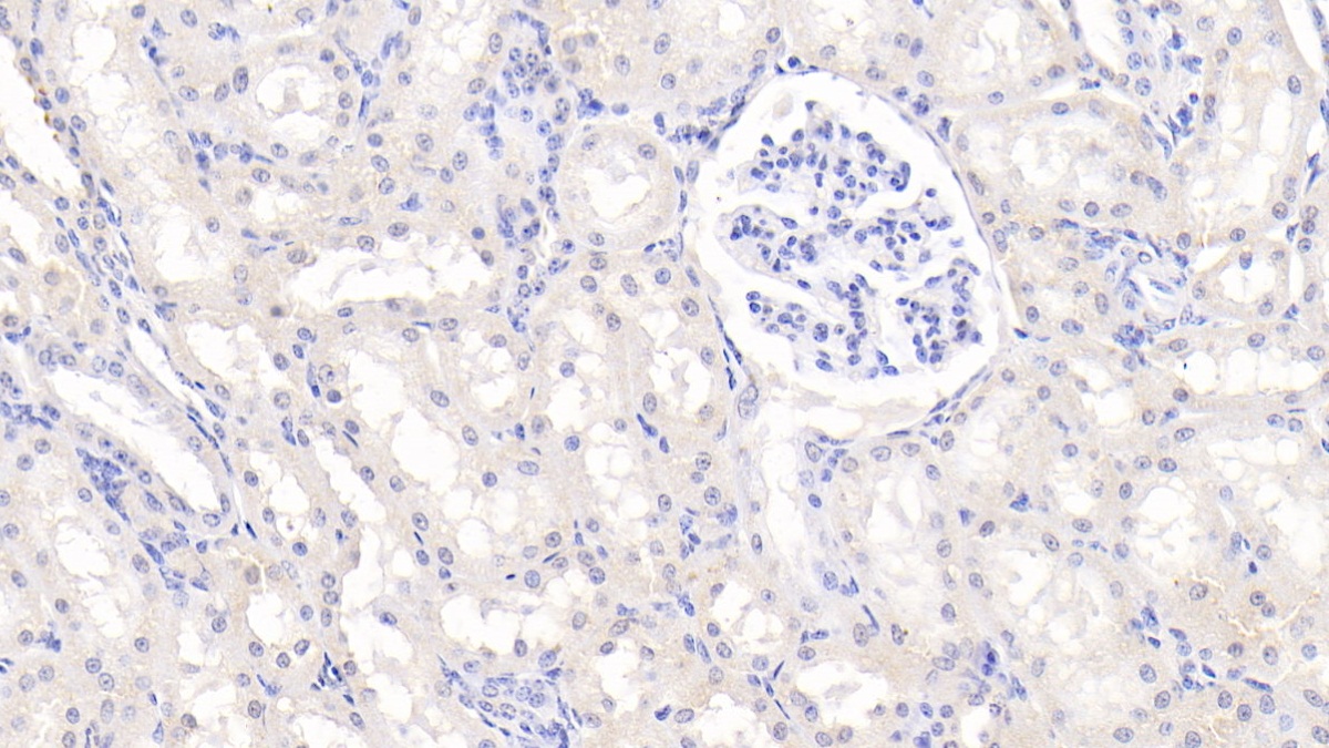 Polyclonal Antibody to Tumor Necrosis Factor Ligand Superfamily, Member 13 (TNFSF13)