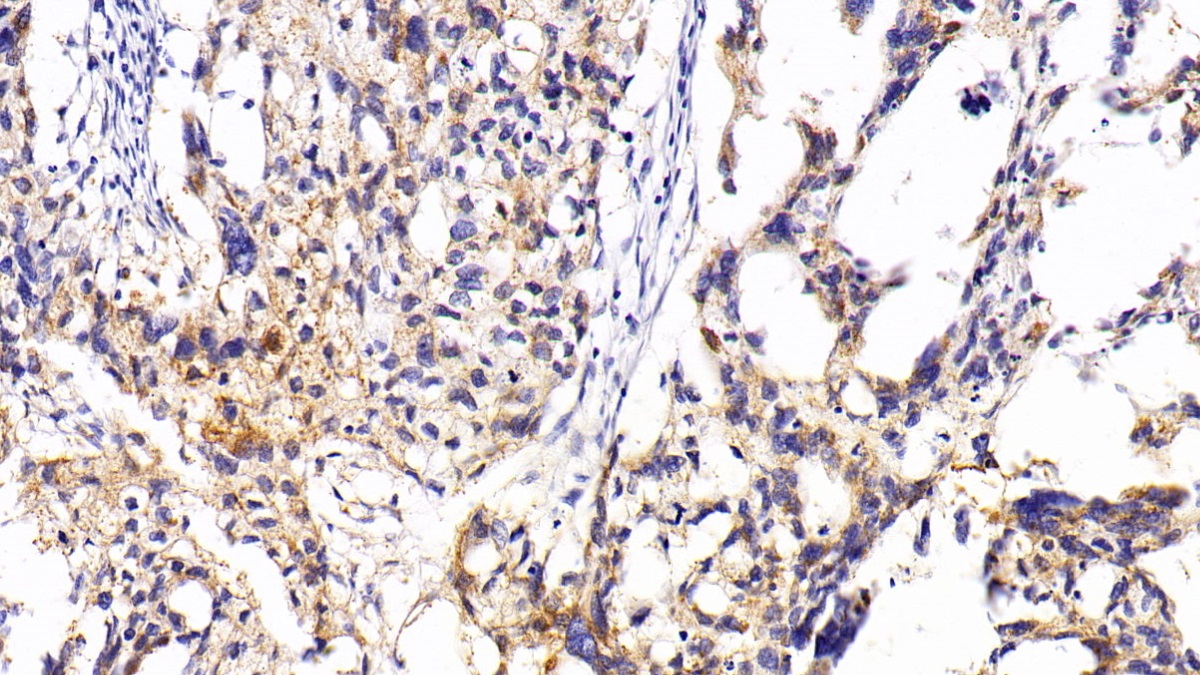 Polyclonal Antibody to Ribonuclease A3 (RNASE3)