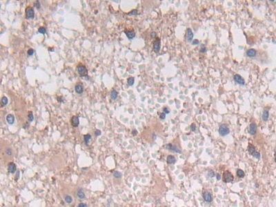 Polyclonal Antibody to Lectin Galactoside Binding, Soluble 3 Binding Protein (LGALS3BP)