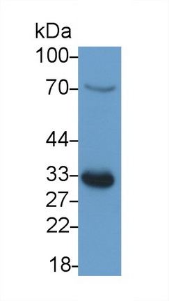 Polyclonal Antibody to Lectin Galactoside Binding, Soluble 3 Binding Protein (LGALS3BP)