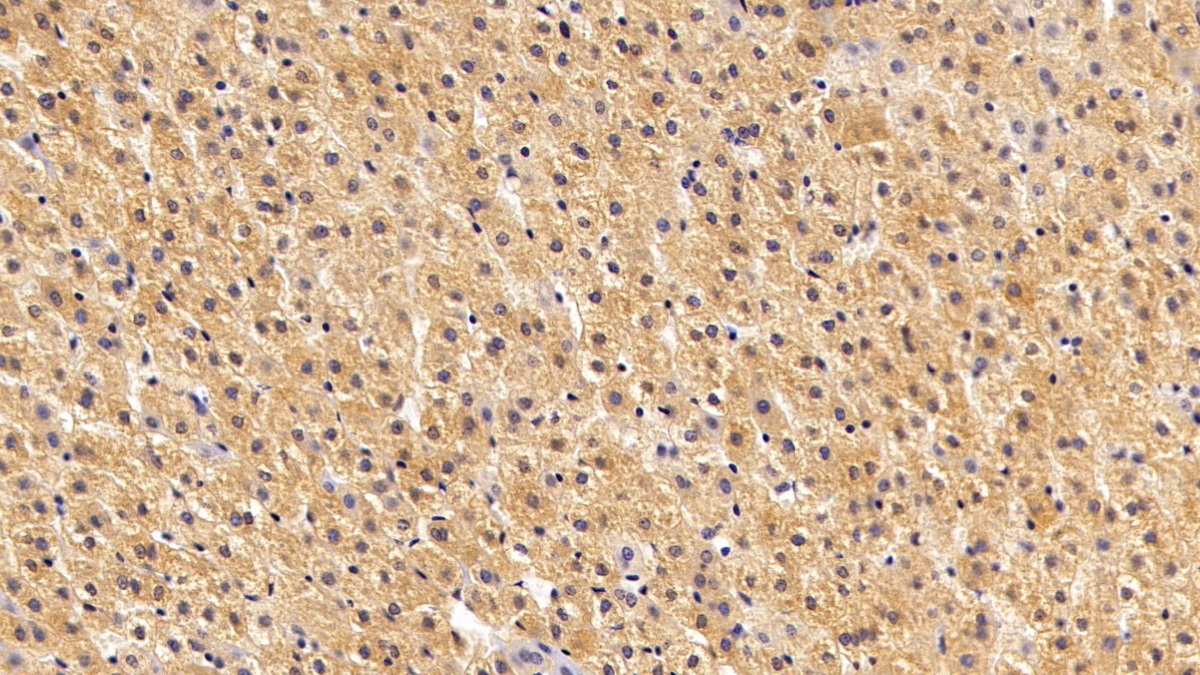 Polyclonal Antibody to S100 Calcium Binding Protein A6 (S100A6)
