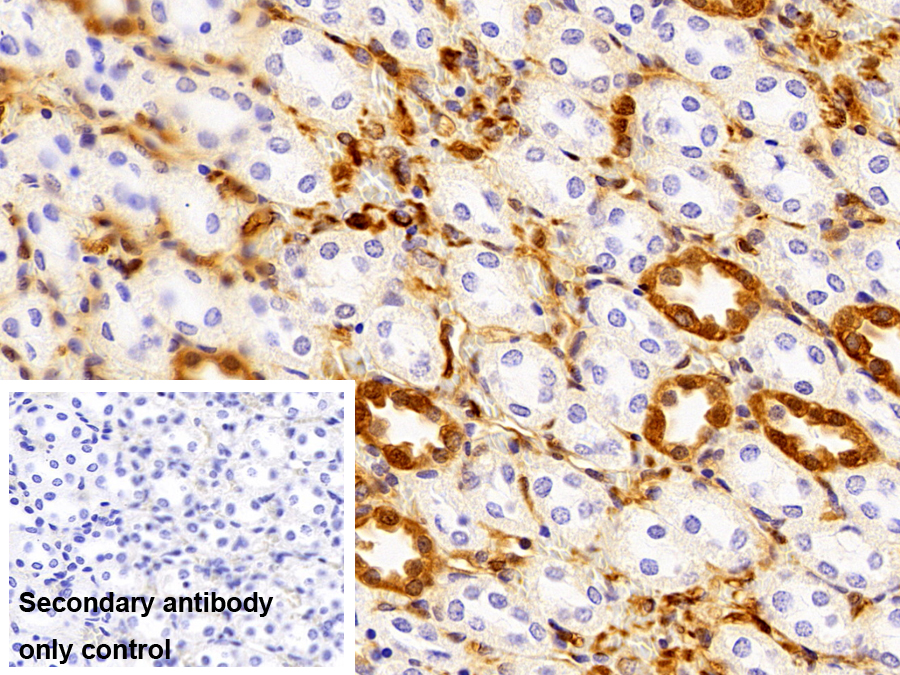 Polyclonal Antibody to S100 Calcium Binding Protein A6 (S100A6)