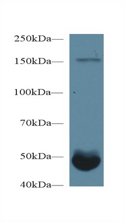 Polyclonal Antibody to Transglutaminase 1 (TGM1)