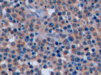 Polyclonal Antibody to Cluster Of Differentiation 7 (CD7)