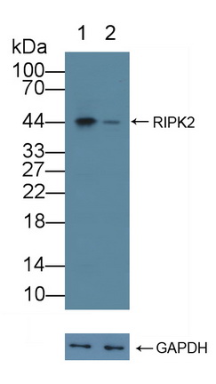 Polyclonal Antibody to Receptor Interacting Serine Threonine Kinase 2 (RIPK2)