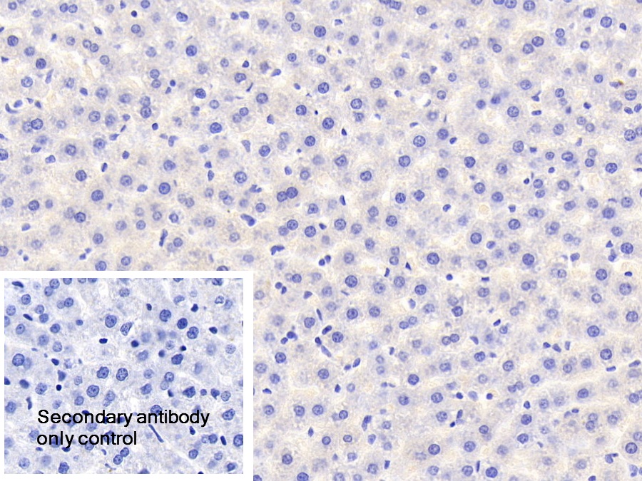 Polyclonal Antibody to Receptor Interacting Serine Threonine Kinase 2 (RIPK2)