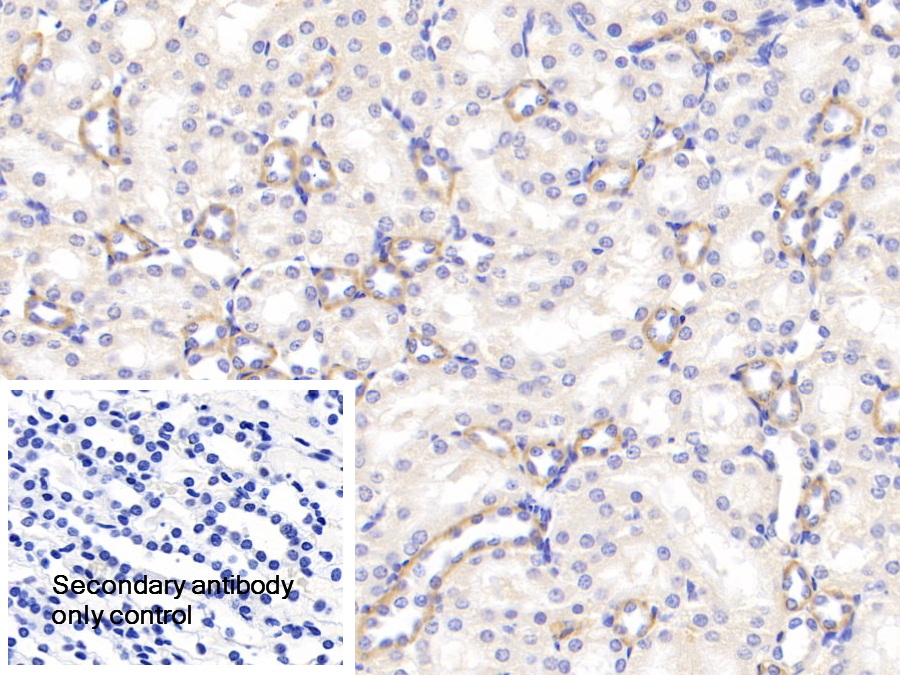 Polyclonal Antibody to Receptor Interacting Serine Threonine Kinase 2 (RIPK2)