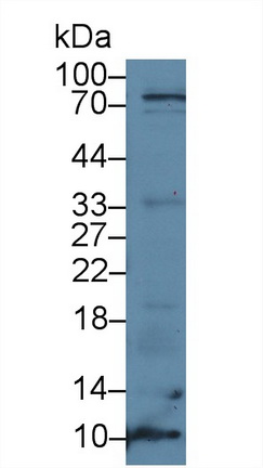 Polyclonal Antibody to S100 Calcium Binding Protein A8 (S100A8)