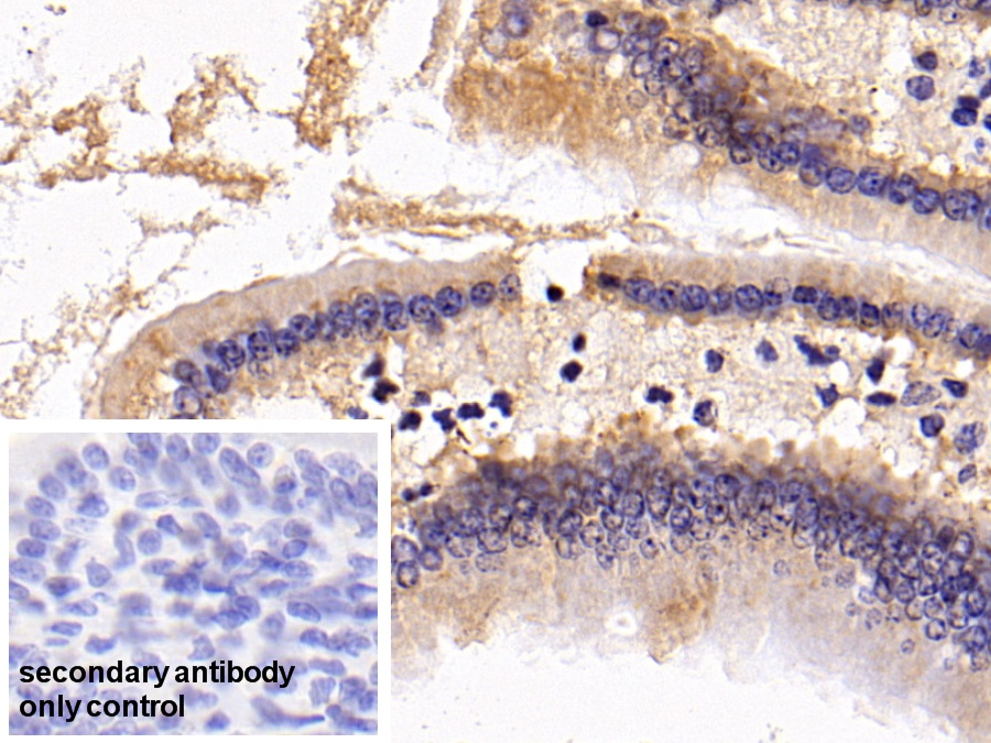 Polyclonal Antibody to S100 Calcium Binding Protein A8 (S100A8)