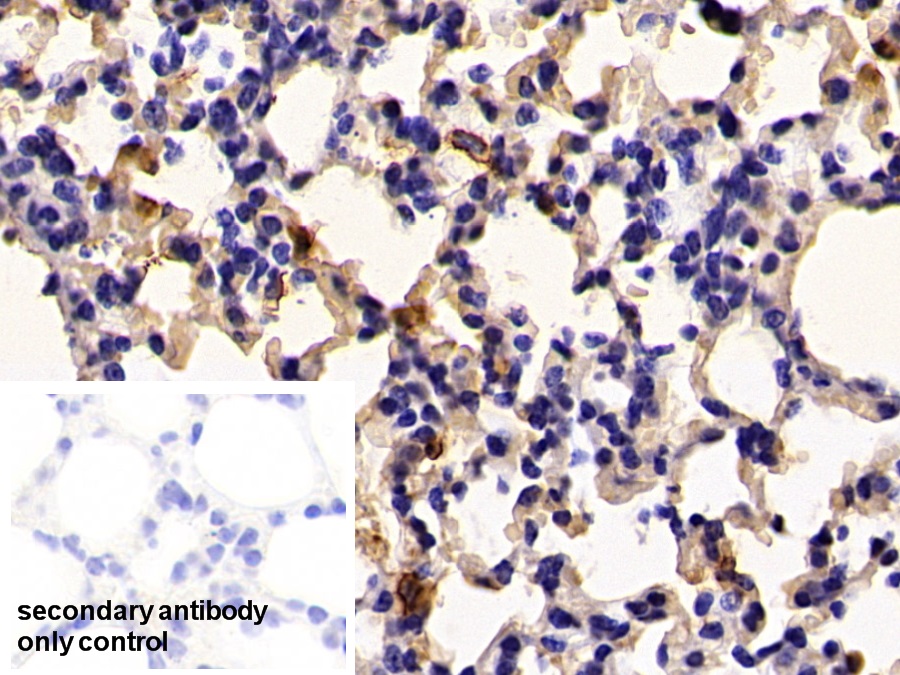 Polyclonal Antibody to S100 Calcium Binding Protein A8 (S100A8)