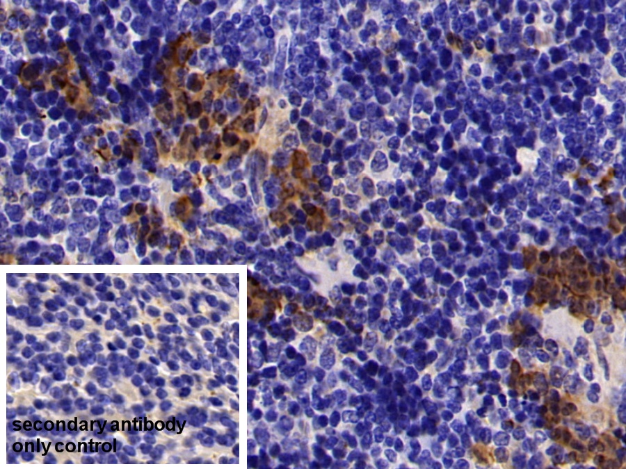 Polyclonal Antibody to S100 Calcium Binding Protein A8 (S100A8)