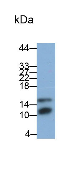 Polyclonal Antibody to S100 Calcium Binding Protein A8 (S100A8)