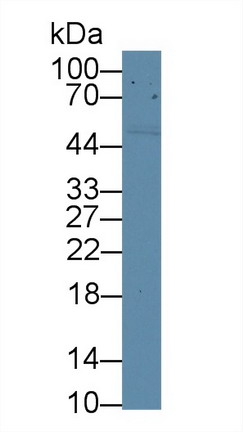 Polyclonal Antibody to Cluster Of Differentiation 5 (CD5)