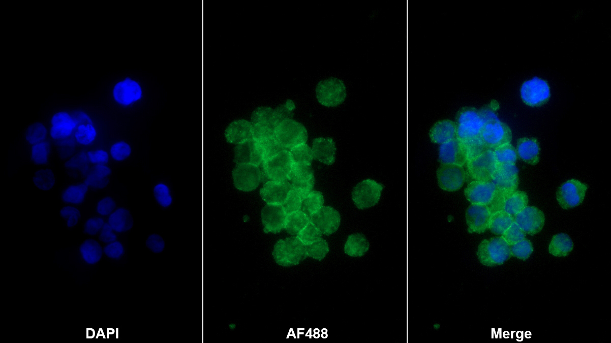 Polyclonal Antibody to Cluster Of Differentiation 5 (CD5)