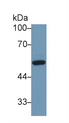 Polyclonal Antibody to Vitamin D Binding Protein (DBP)