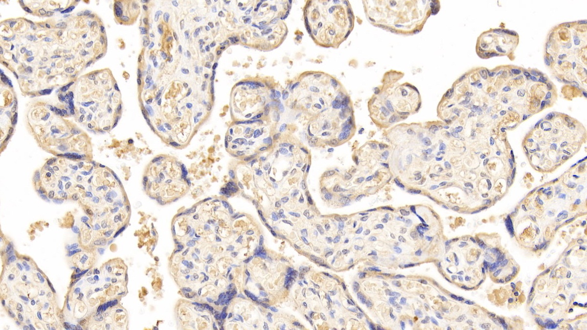 Polyclonal Antibody to Vitamin D Binding Protein (DBP)