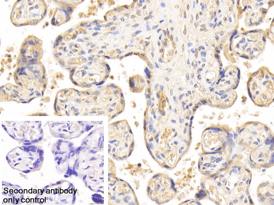 Polyclonal Antibody to Vitamin D Binding Protein (DBP)