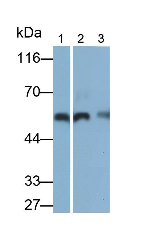 Polyclonal Antibody to Vitamin D Binding Protein (DBP)